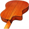 Cordoba C5-CET Elektro Klasik Gitar<br>Fotoğraf: 4/5