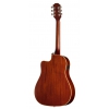 Epiphone J-45 Standard EC Elektro Akustik Gitar (Honey Burst), Fotoğraf: 4/4