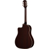 Epiphone J-45 Studio EC Elektro Akustik Gitar (Vintage Sunburst), Fotoğraf: 3/3