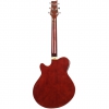 [Outlet] Ashton DuallerTSB Elektro Klasik Gitar (OL 23-23129)<br>Fotoğraf: 4/5