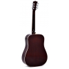 Sigma SDM-SG5 Dreadnought Elektro Akustik Gitar (Autumn Burst), Fotoğraf: 4/4